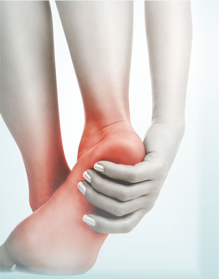 Fasciíte ou Fascite Plantar Stay Care